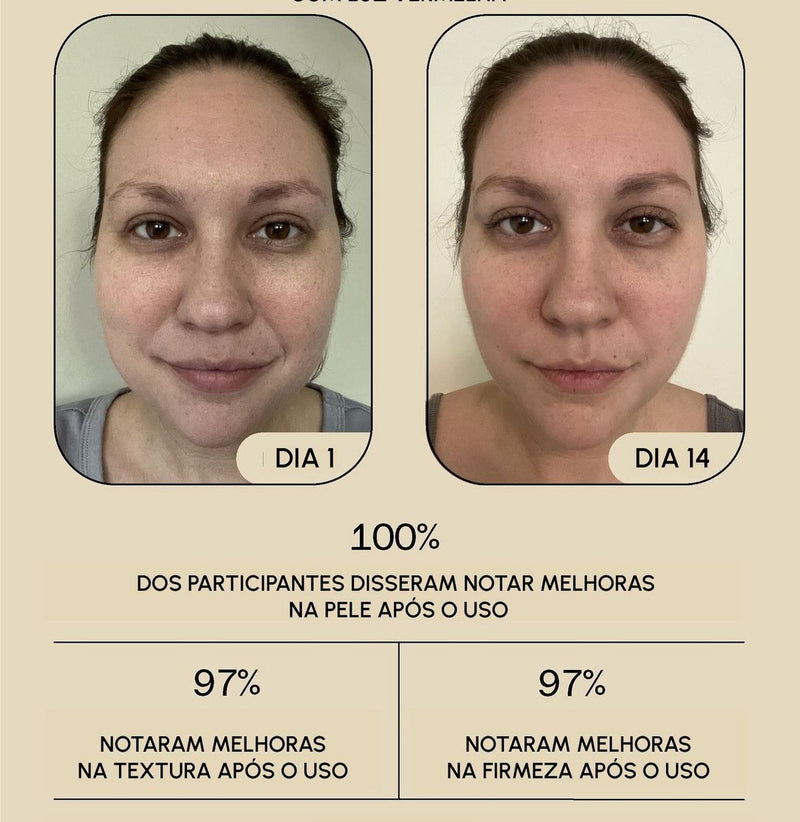 BotoxLaser - Acabe Com as Rugas em 7 dias + BRINDE EXCLUSIVO