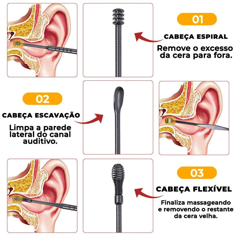 Removedor de Cera de Ouvido Profissional - kit 6 Unidades